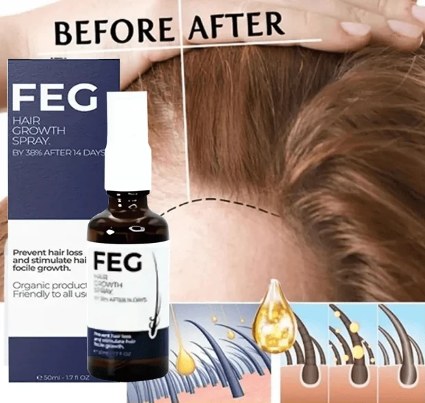 FEG Hair Growth Spray - Regrow Hair Fast Solution for Men & Women | 03001819306