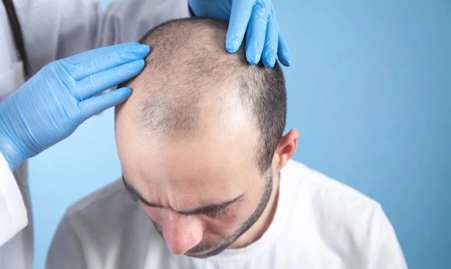 Want Hair Ltd - Trusted FUE Hair Transplant Clinic in Manchester